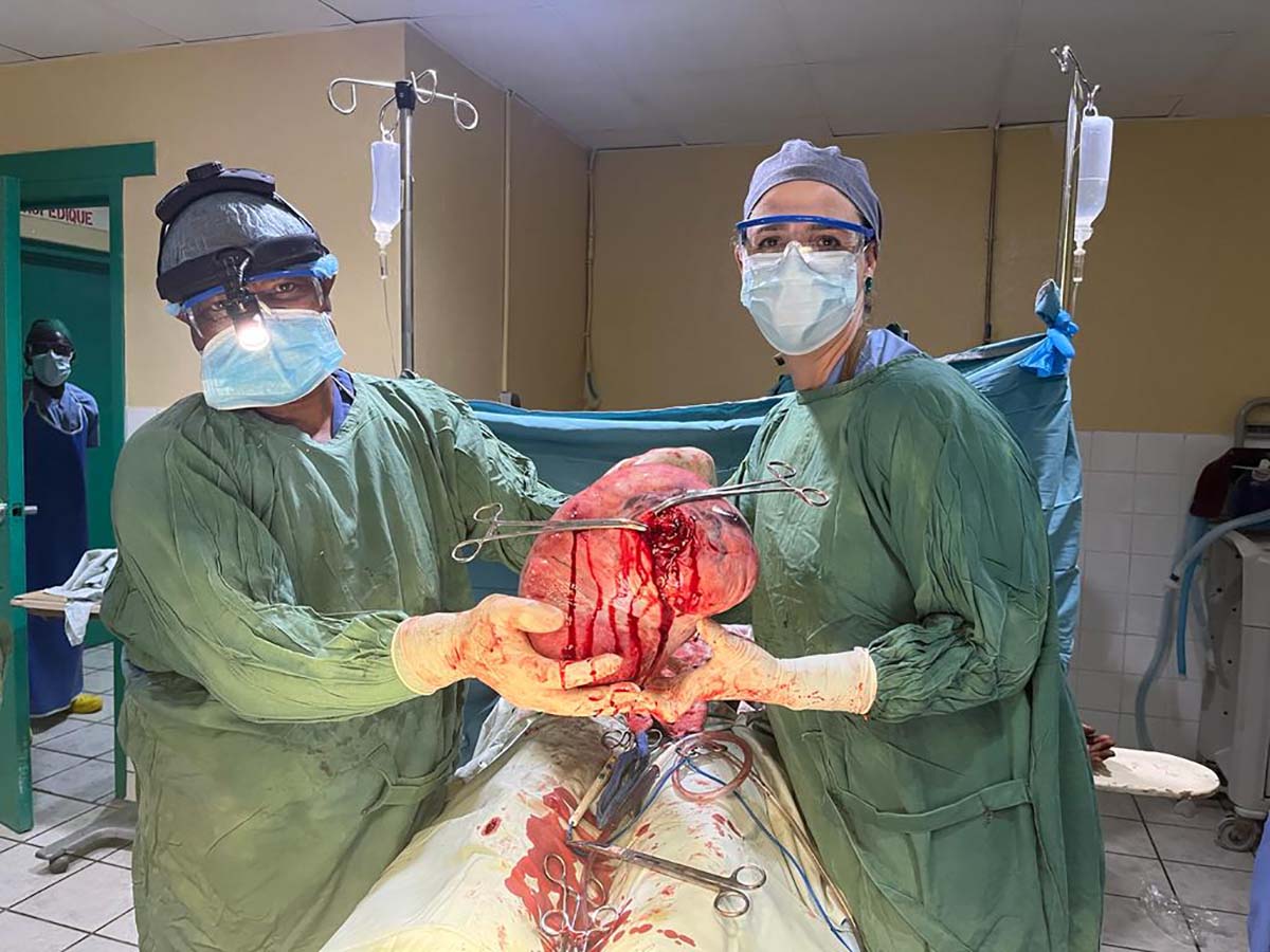 Finally free from her giant uterine myoma of 6100 grams 